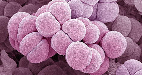 Neisseria meningitidis, Vergrößerung 20000-fach. (© /RKI) Neisseria meningitidis, Vergrößerung 20000-fach.